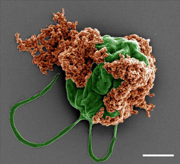 Colored SEM image of a microrobot made of an algae cell (green) covered with drug-filled nanoparticles (orange) coated with red blood cell membranes