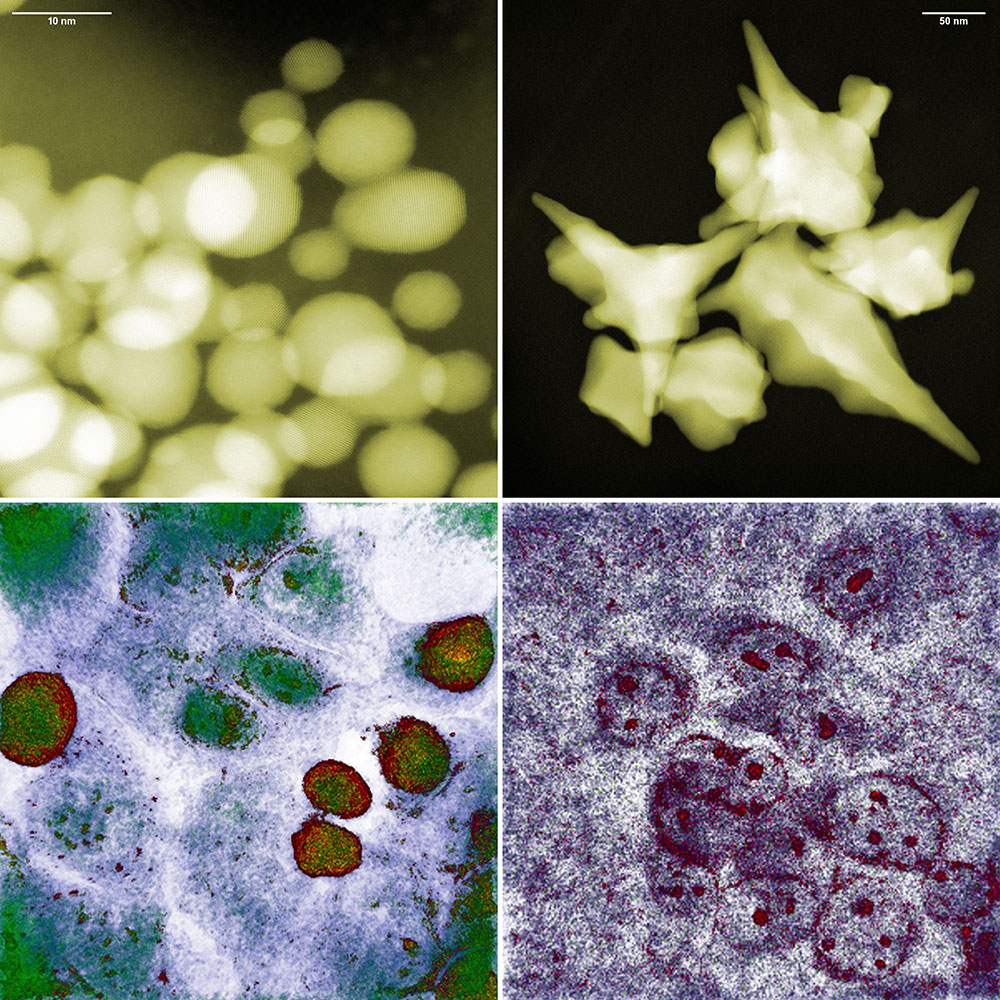 pherical and star-shaped gold nanoparticles (top) and colon cancer cells