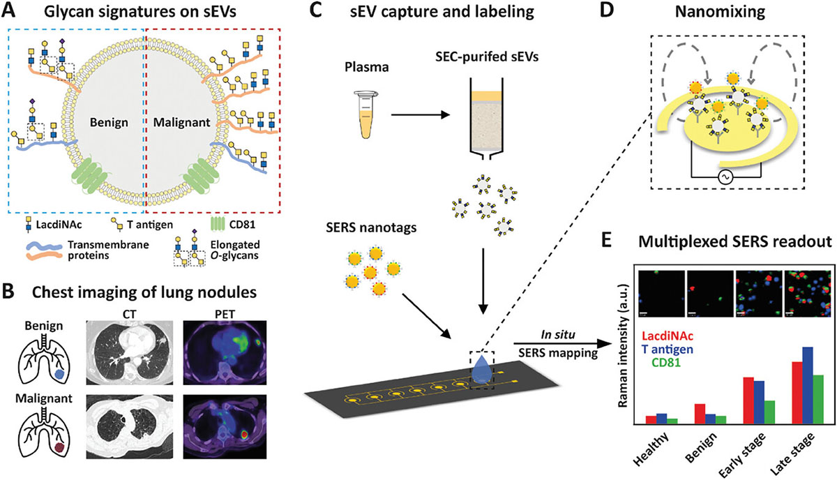 Principle of extracellular vesicles GLYPH assay for early-stage NSCLC identification