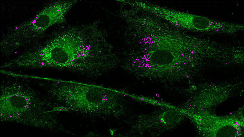 Nanoparticles interacting with the mitochondria