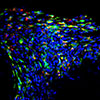 Researchers find intriguing new tool for tendon healing: nanoparticles for precision drug delivery