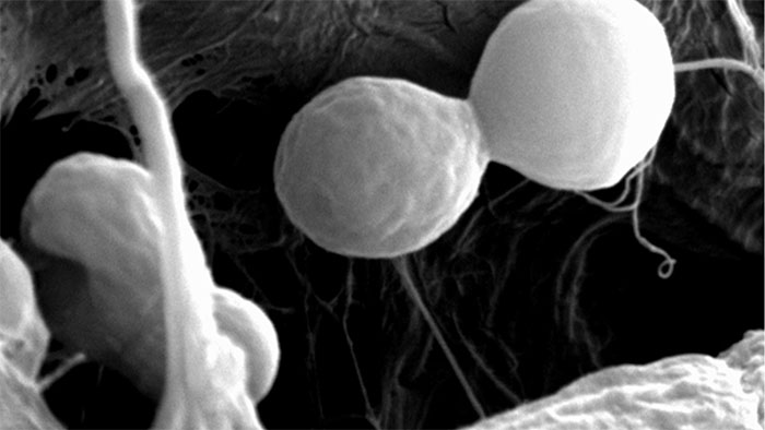 Electron microscopy image of the yeast cell D. hansenii, a robust cell that thrives in highly saline environments