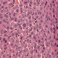 liver_histology