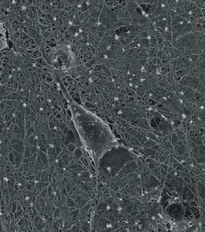 SEM micrograph of a cultured rat hippocampal neuron grown on a layer of purified carbon nanotubes